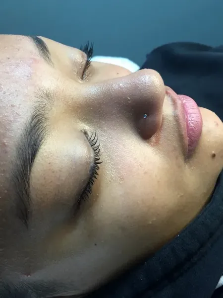 Burkit Beauty Clinic - Home Based Clinic