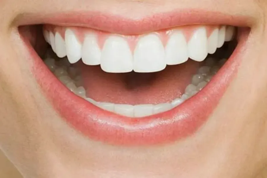 Baywide Smiles Dental
