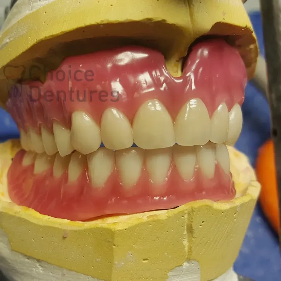 Choice Dentures