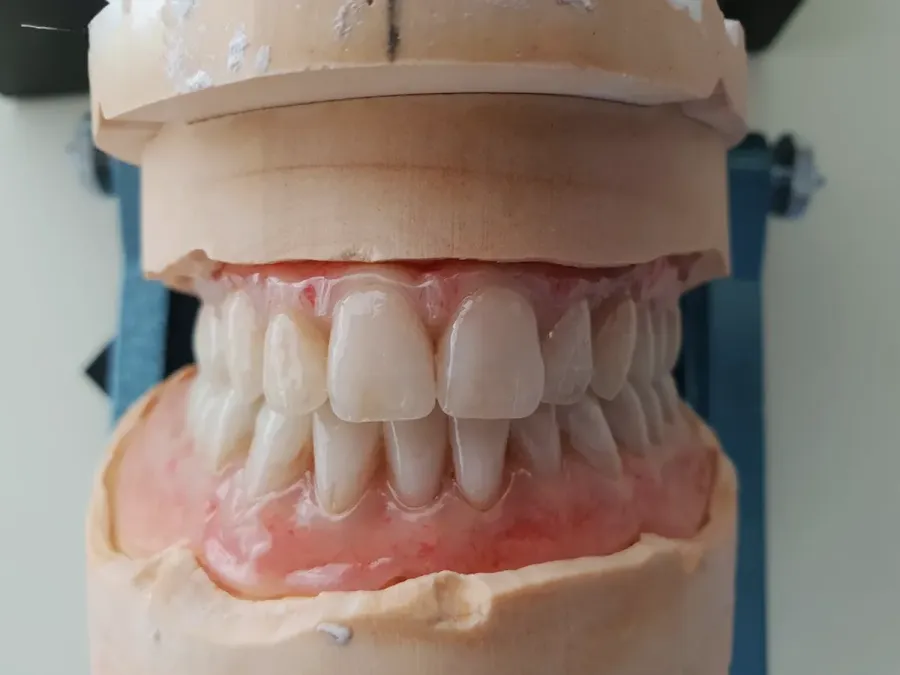 Artisan Denture Studio - Dentures in Napier